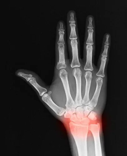 Diagnosis - Carpal Tunnel Surgery Clinic