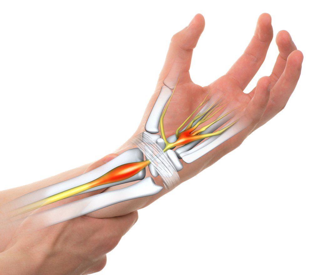 after-surgery-carpal-tunnel-surgery-clinic